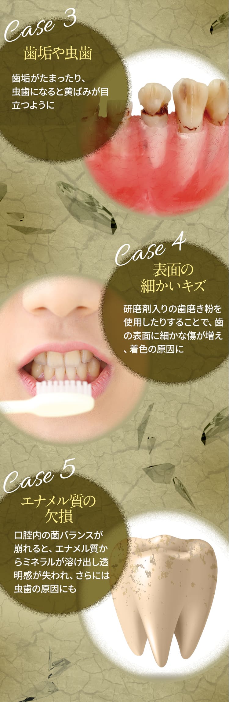 CASE3歯垢や虫歯　CASE4表面の細かいキズ　CASE5エナメル質の欠損